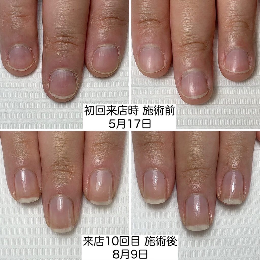 松山市ネイルサロン｜爪のお手入れ・ネイルケア専門店のケアラボT-NAIL