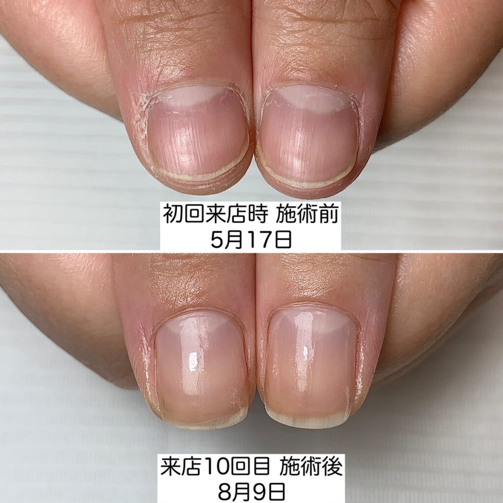 松山市ネイルサロン｜爪のお手入れ・ネイルケア専門店のケアラボT-NAIL